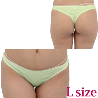 ���Ȃ��݂̗ǂ��R�b�g���V���v���s�o�b�N�k�@�O���[���i�����W�F���[�j